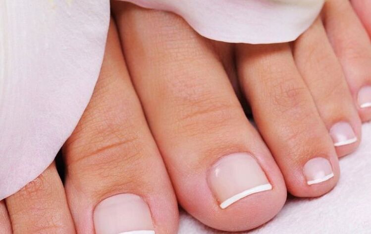 signs and symptoms of nail fungus